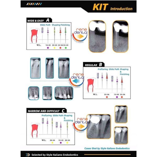 Limas Fanta F-One 13/03 Essential Kit X 5 - Imagen 2