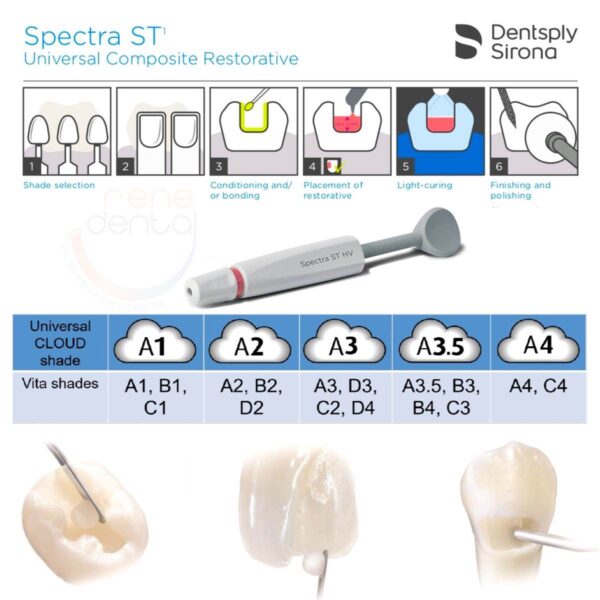 Composite Neo Spectra ST Dentsply